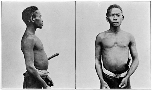 Negrito man of Zambales (pure blood).