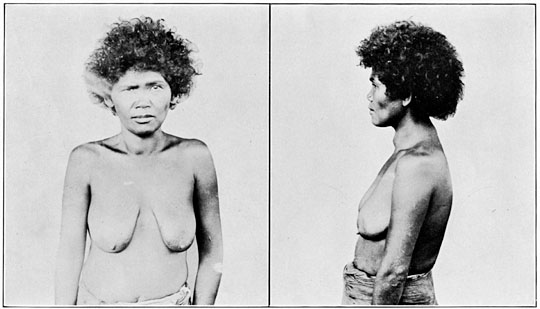 Negrito woman of Zambales (mixed blood).